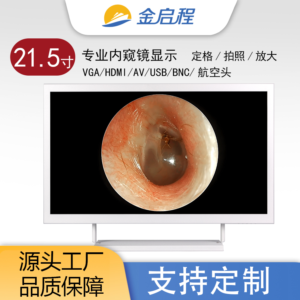 21.5寸白色金属壳高清全视角显示器| 专业医疗显示内窥镜显示可视化采耳设备